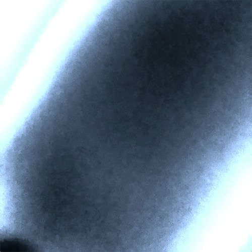 Anderson (Alternate Version) cover art