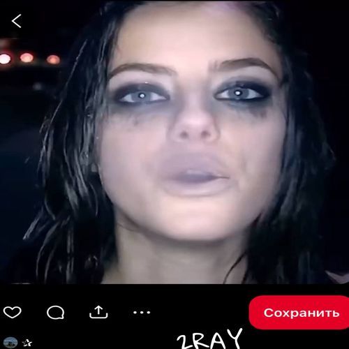 Anorexy B