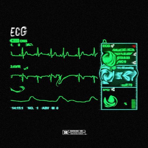 ECG