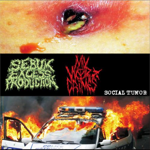 Trichilemmal cyst cover art