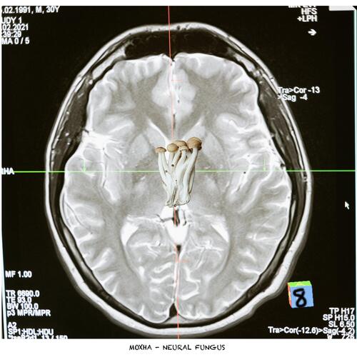 Neural Fungus cover art
