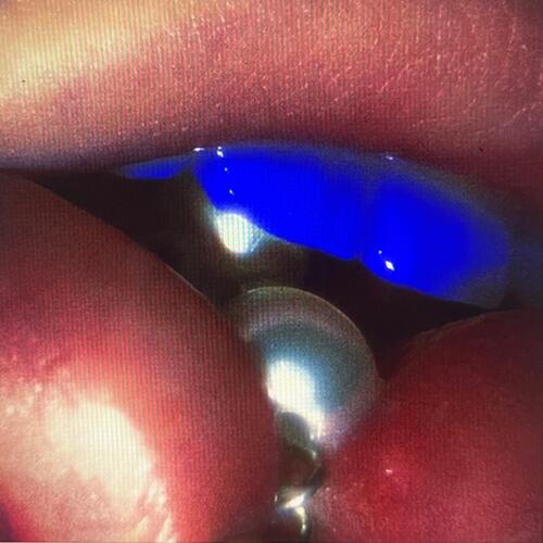 funk gunk