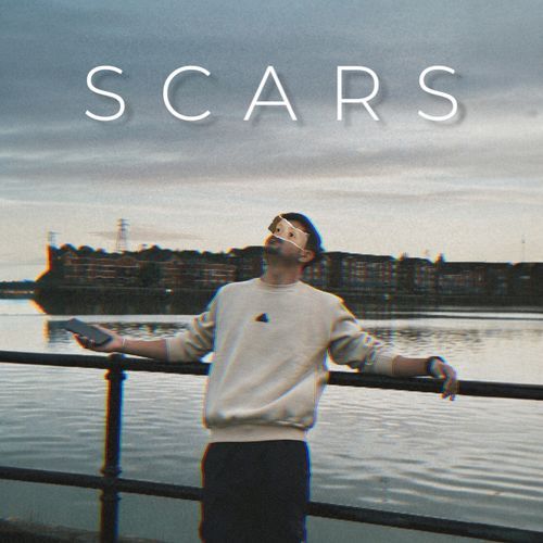 Scars