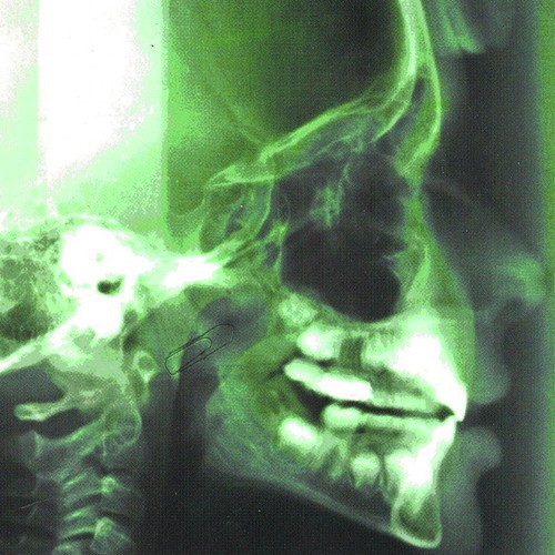 Aivan Kuin Kaikki Muutkin