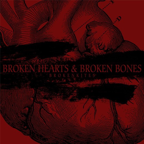 Broken Hearts and Broken Bones