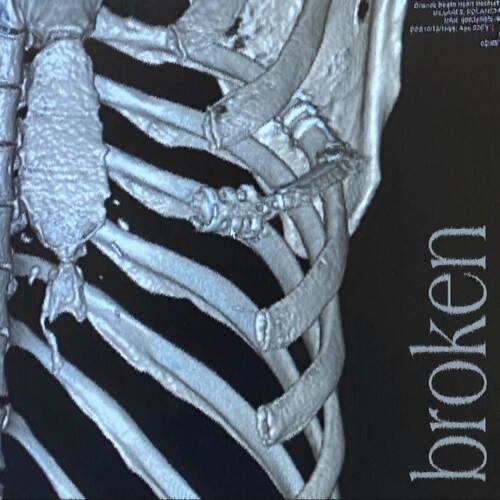 Broken