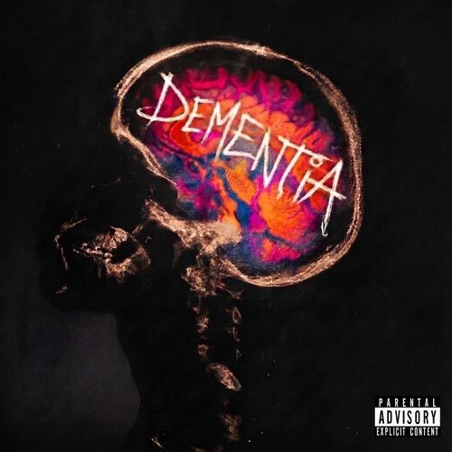 Dementia