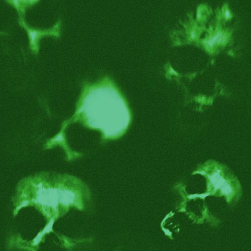 Shuttered! (Slowed+Reverb) cover art