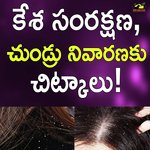 Kesha Samrakshana, Chundru Nivaranaku Chitkalu