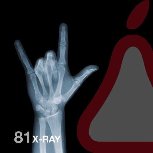 X-Ray