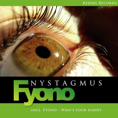 Nystagmus