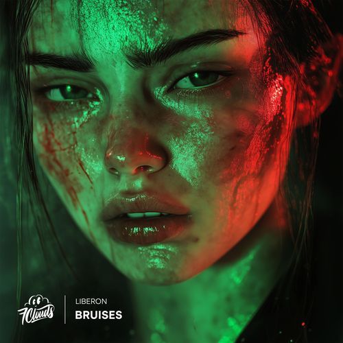 Bruises