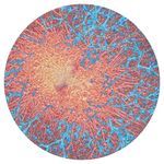 Pattern Index