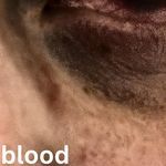 Blood