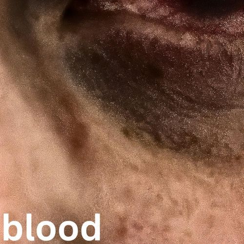 Blood