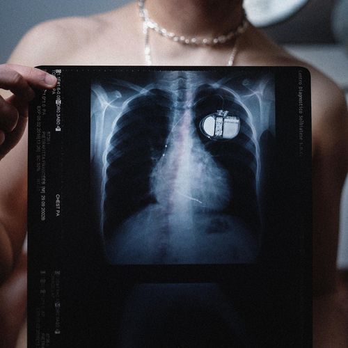 Francesco cover art