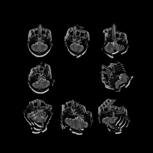 Ex-Mamífero Moderno cover art