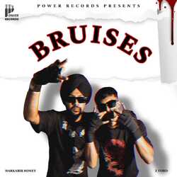 Bruises-JlgOYz8ABHU