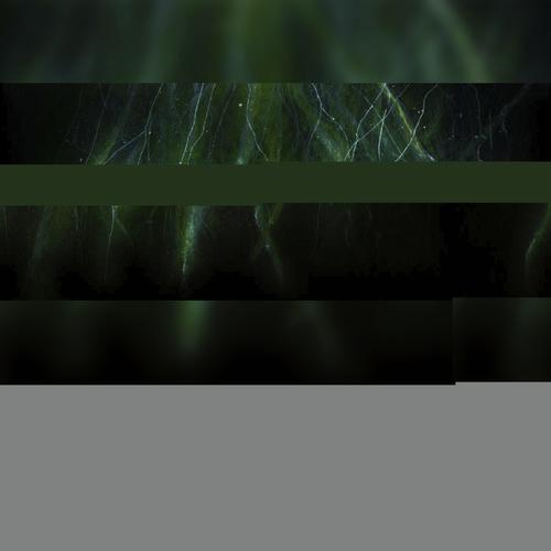 Síndrome de la NO pertenencia cover art