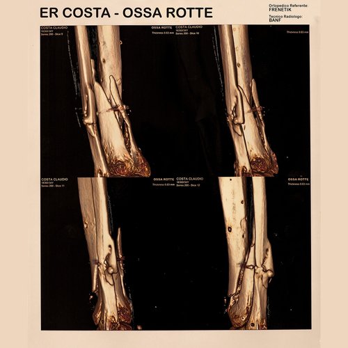 Ossa rotte_poster_image