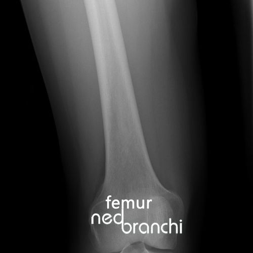 Cracking Bones cover art