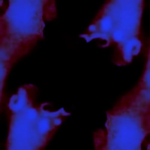 Prosthetics cover art