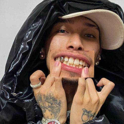 Não Confio em EX cover art