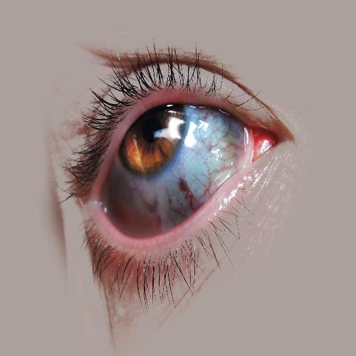 Kletch Nass cover art