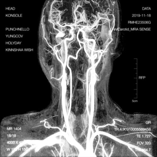 Head (feat. Punchnello) cover art