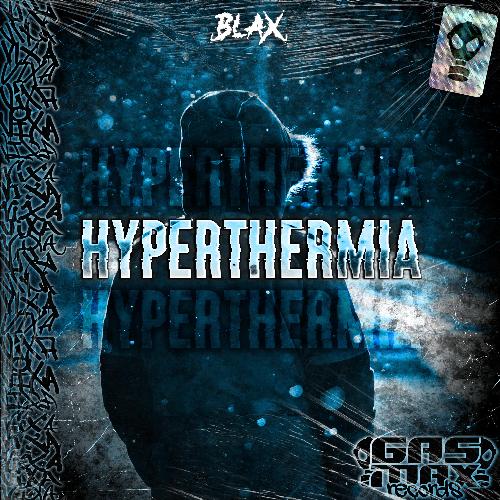 Hyperthermia