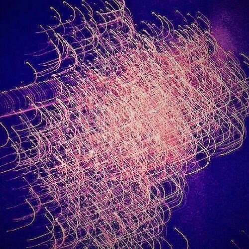 Does It Hurt cover art
